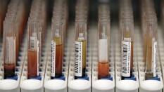 Google anuncia una alianza con una farmaceútica para luchar contra la diabetes