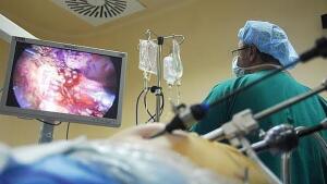 Hallan cómo detectar los pólipos ‘ocultos’ para prevenir el cáncer colorrectal