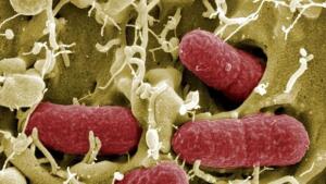El ayuno terapéutico modula las enfermedades gastrointestinales infecciosas