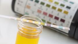 Dime de qué color es tu orina y te diré cómo está tu salud